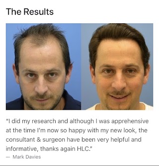 Liverpool Hair Loss Clinic