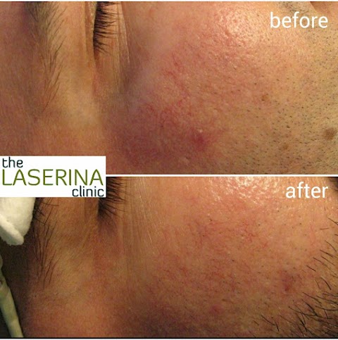 the LASERINA Clinic