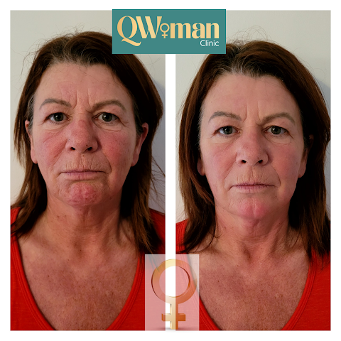 QWoman Clinic