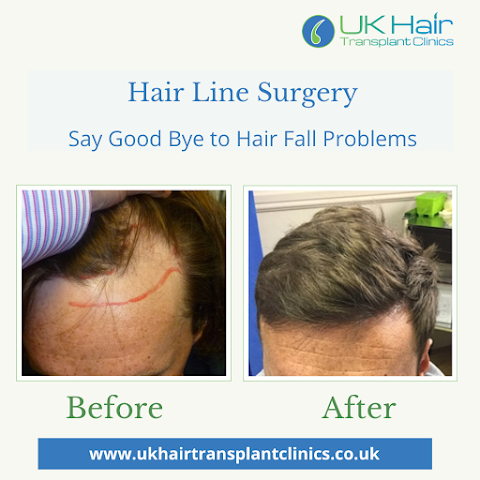 UK Hair Transplant Clinics Belfast