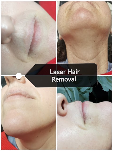 Cheadle Laser Clinic - Laser Hair Removal I HIFU I Tattoo Removal I Carbon Peel