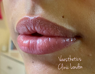 Vaesthetics Clinic London