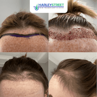 Sheffield Hair Transplant Clinic