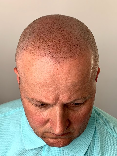 Hair Savvy Studio - Scalp Micropigmentation Clinic