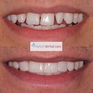 Market Dental Care