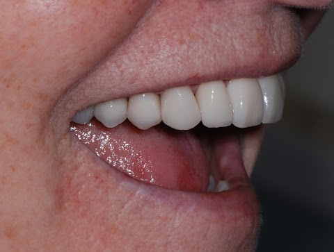 London Smile Care Dentist and Dental Implants