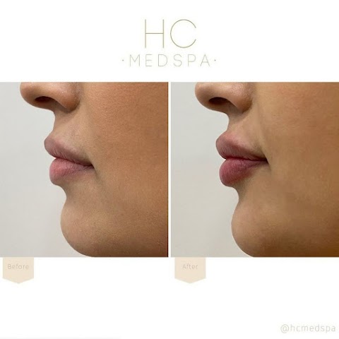 HC MedSpa Aesthetic & Beauty Clinic Barnet