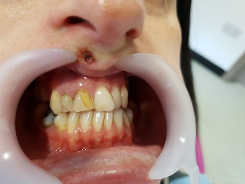 Dental Implant Centre Aberdeen