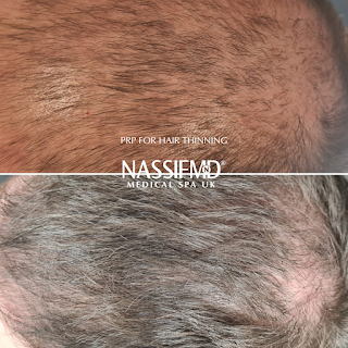 NassifMD Medical Spa UK