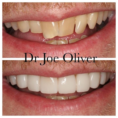 Dr Joe Oliver - Cosmetic Dentist Manchester Clinic