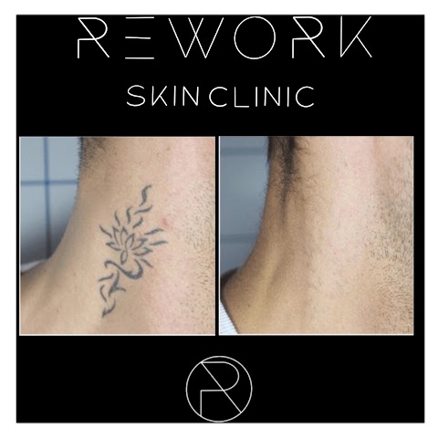 ReWork Skin Clinic