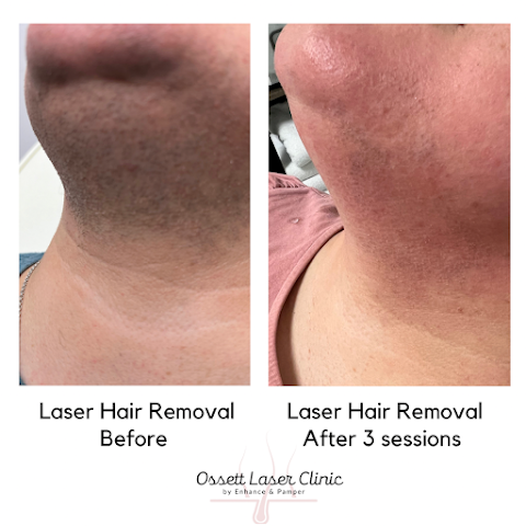 Ossett Laser Clinic