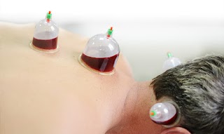 Hijama Therapy Cupping Clinic