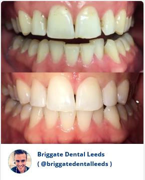 Briggate Dental