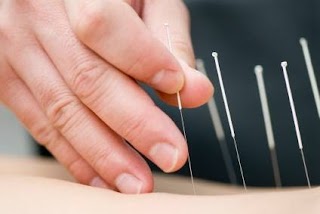 Upton Clinic(Professional acupuncture centre)