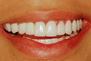 Invisalign Solihull - Widney Dental