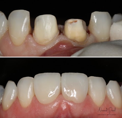 Precision Dental Clinic