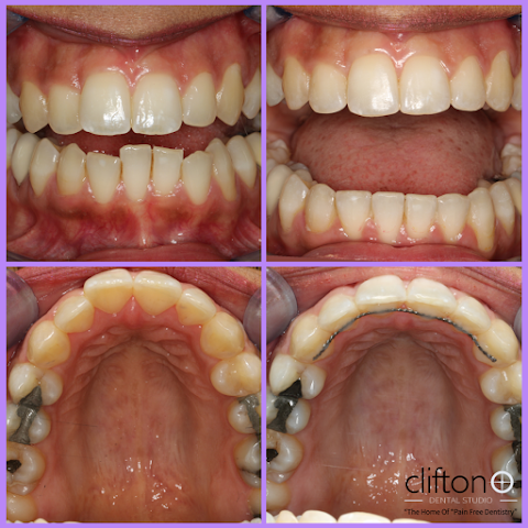 Clifton Dental Studio