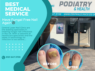 Central Laser Nail Clinic Solihull