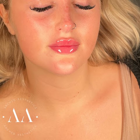 Arched Aesthetics | Aesthetic Treatments & Lip Fillers Plymouth