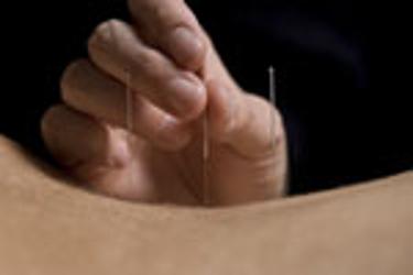 Acupuncture Care Clinic