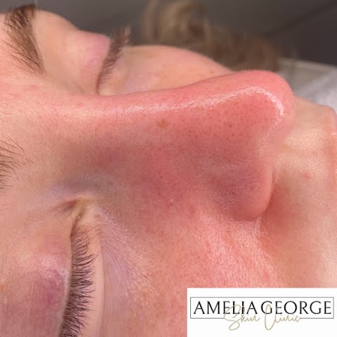 Amelia George Skin Clinic