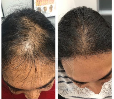 Hair Loss Clinic