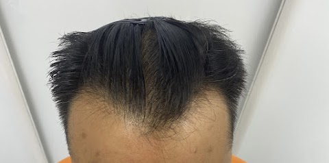 London Hair Transplant Clinic