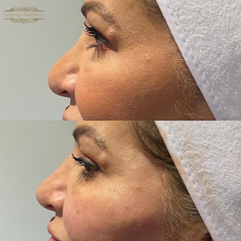 Surgicare Aesthetics Barnet: Specialist Doctors In Botox , Non-Surgical Rhinoplasty, Lip Fillers & Morpheus8