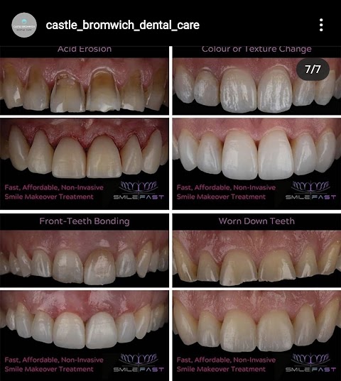 Castle Bromwich Dental Care