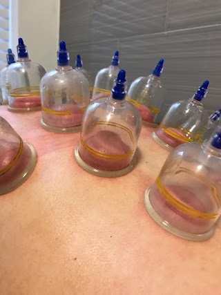 Cupping Treatment, Manchester