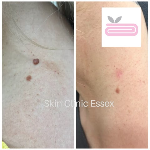 Skin Clinic Essex