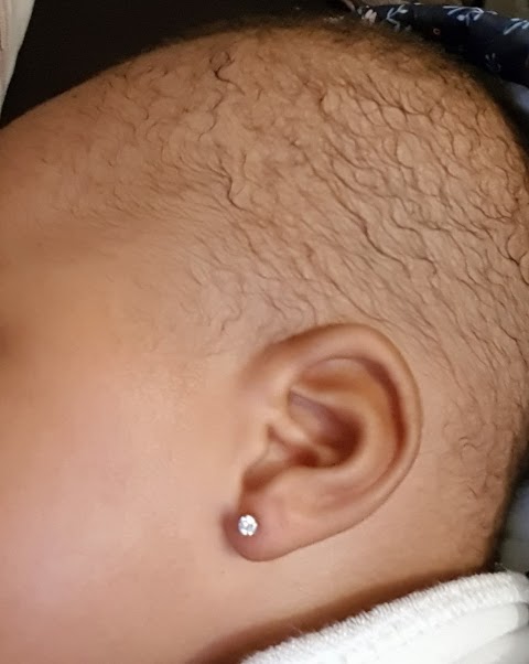 Baby's Ears