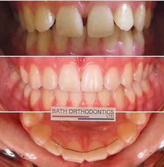 Bath Orthodontics