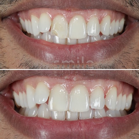 Smile Cliniq - St Johns Wood