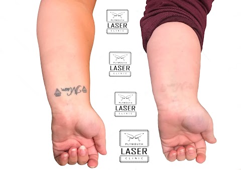 Plymouth laser clinic