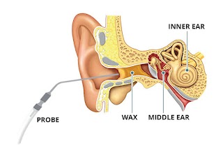 Northwood Ear Wax Clinic @ sharmans