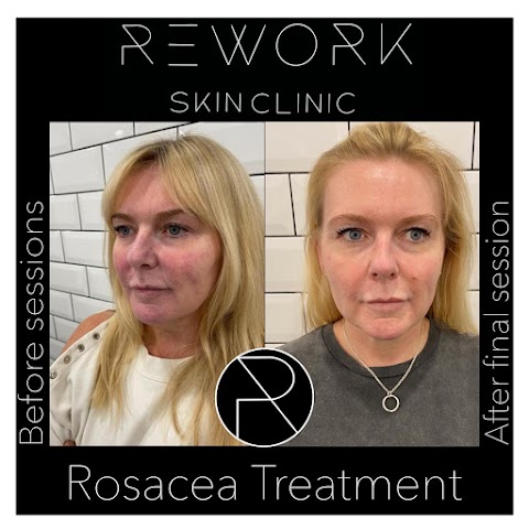 ReWork Skin Clinic