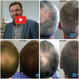 Dr. André Nel - Hair Restoration Clinic