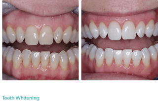 Perfect Smile Dental - Earlsfield