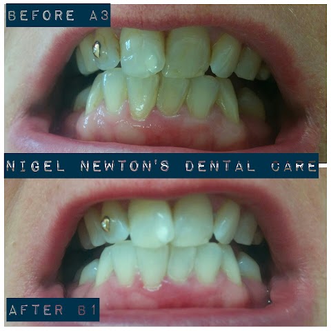 Nigel Newton's Dental Care