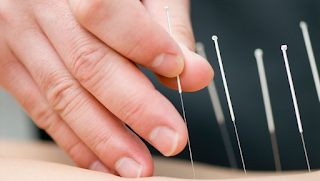 Glenfield Acupuncture