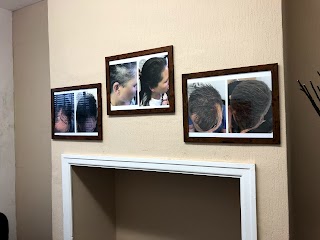 Leeds Hair Loss Clinic