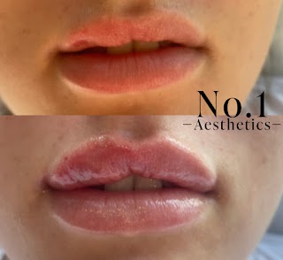 No.1 Aesthetics Ltd