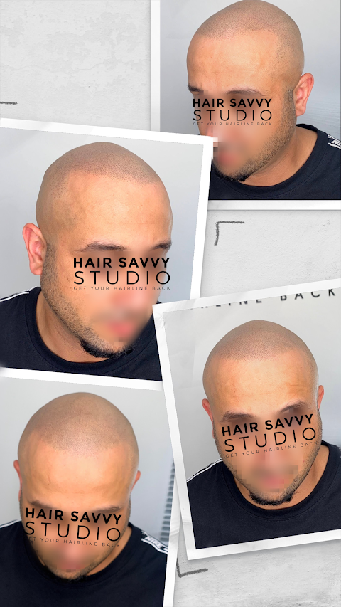 Hair Savvy Studio - Scalp Micropigmentation Clinic