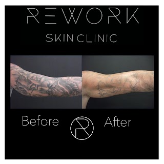 ReWork Skin Clinic