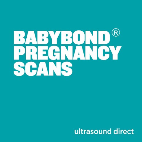 Ultrasound Direct London Wimbledon - Babybond