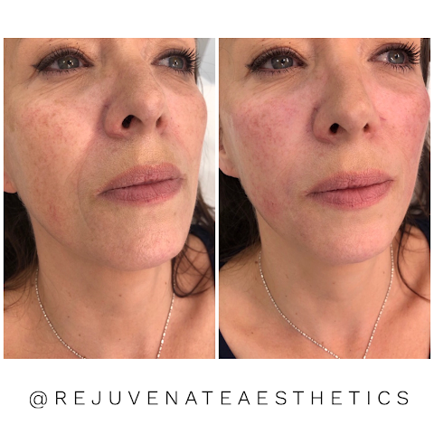 Rejuvenate Aesthetics Clinic - Nurse Prescriber Led Medical Clinic in Southampton