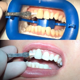 Chelsea Dental Clinic