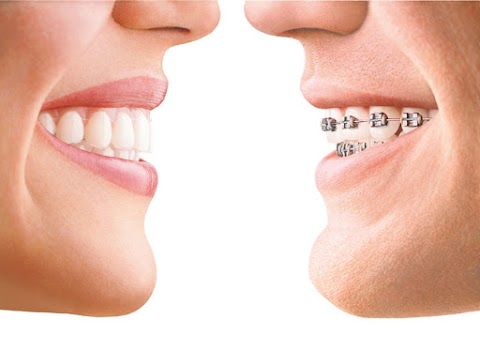 Teeth in Line Orthodontics